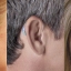 hearingaids